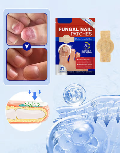Fungal Nail Patches